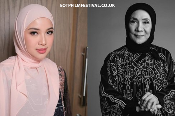 Ibunda Chacha Frederica Patah Tulang Karena Kecelakaan Motor