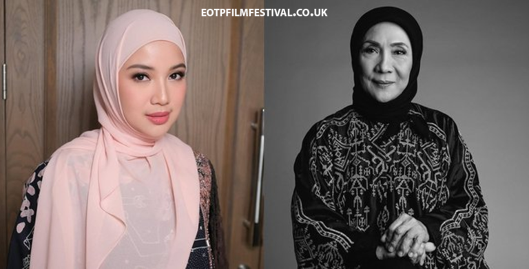 Ibunda Chacha Frederica Patah Tulang Karena Kecelakaan Motor