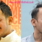 Ruben Onsu Dari Masa Sulit