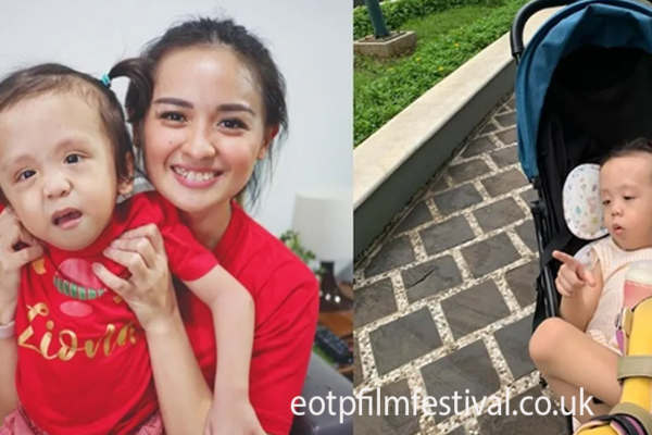 Joanna Alexandra Hadapi Tantangan Besar Saat Putrinya, Ziona, Didiagnosis Campomelic Dysplasia Joanna Alexandra
