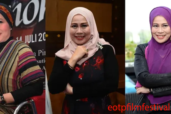 Dewi Yull Ungkap Kronologi Kehilangan Penglihatan Sebelah Mata Akibat Ablasi Retina Dewi Yull