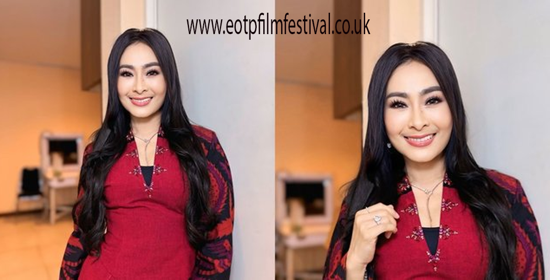 Iis Dahlia Usai Operasi